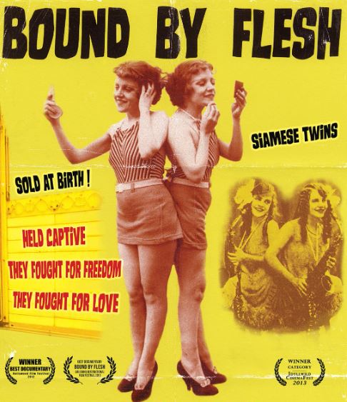 Fortuna Erotica dei “Freaks”, e loro complicati ménage matrimoniali (2)