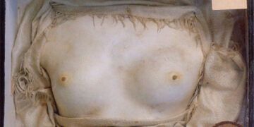 Le nuove Gorgoni (2): i “Metallizzatori”