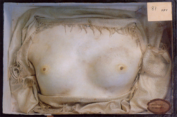 Le nuove Gorgoni (2): i “Metallizzatori”